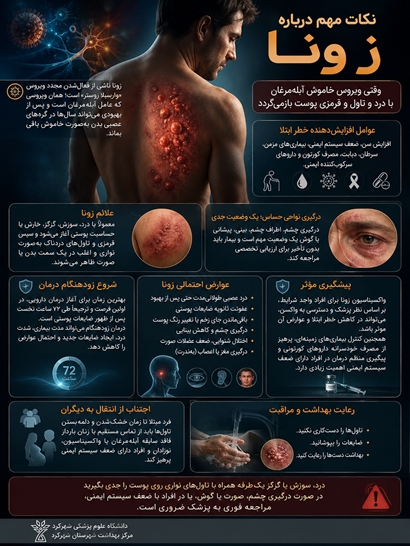نکات مهم بیماری زونا